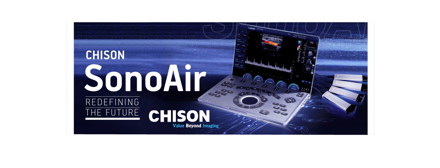 simus chison sonoair